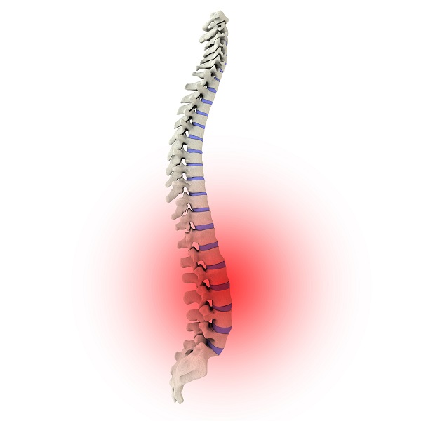 Fisioterapia